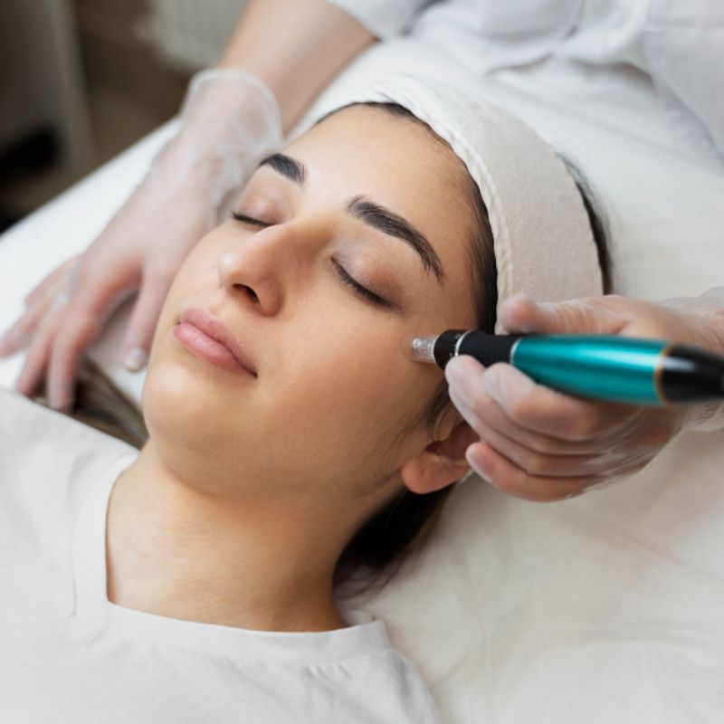 Morpheus 8 (for scars, toning, brightening)