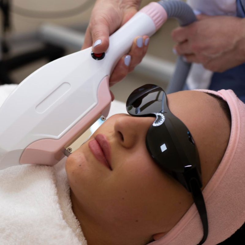 Non-Surgical Lifting with HIFU