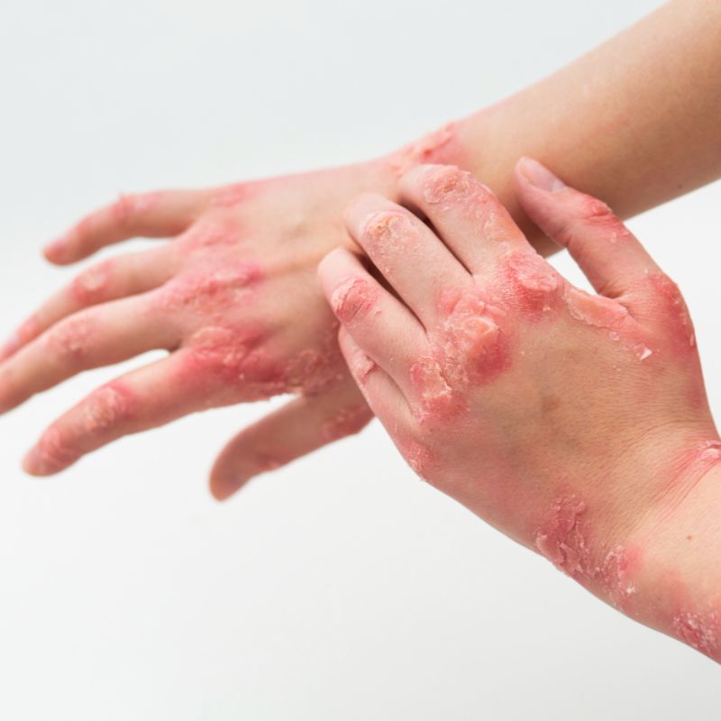 Skin Allergies & Sensitivities
