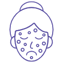 Pigmentation Disorders (Melasma, Freckles)