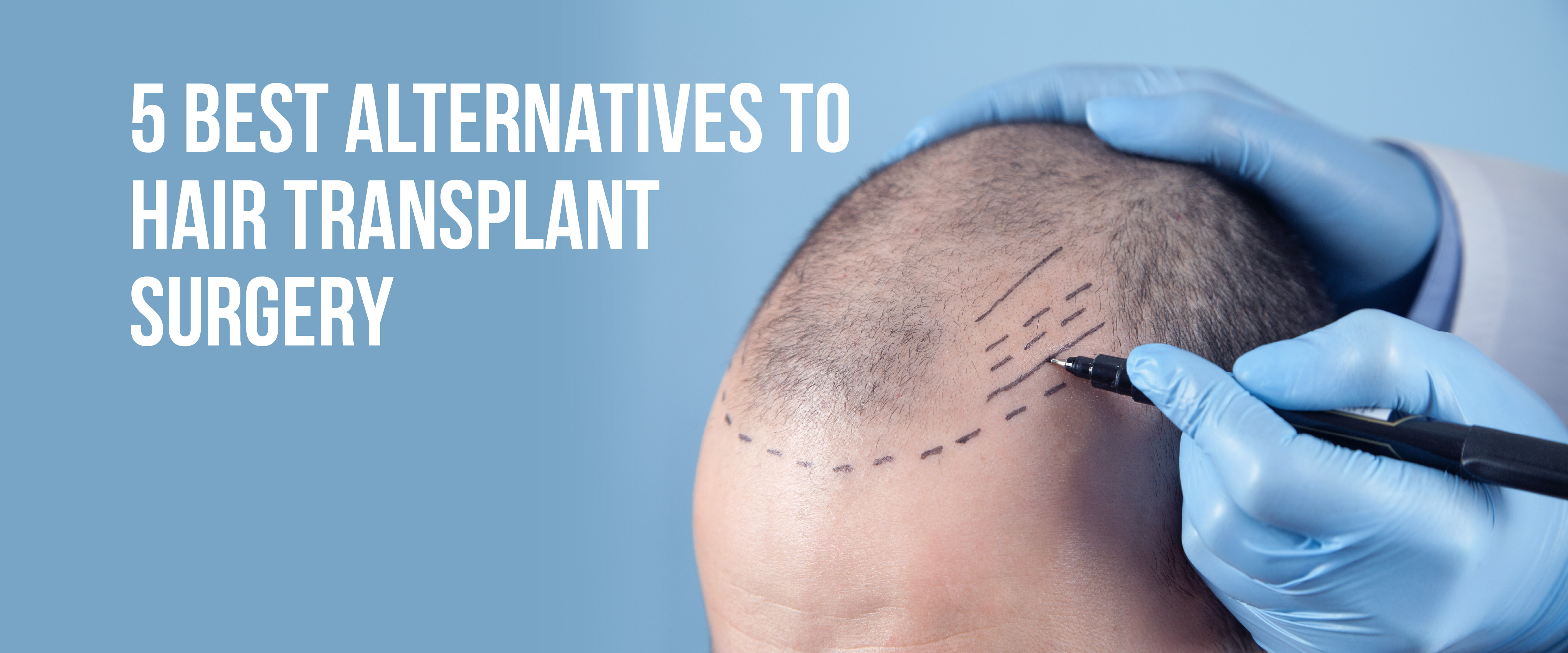 Hair Transplant Surgery